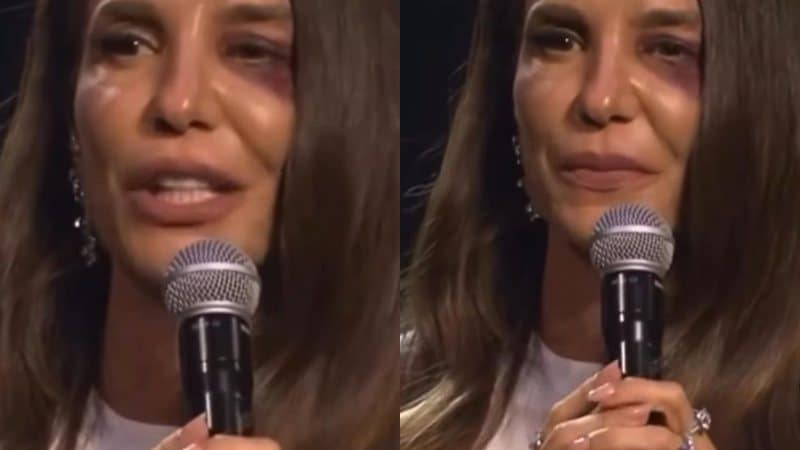 Ivete machucada » Gnews Bahia