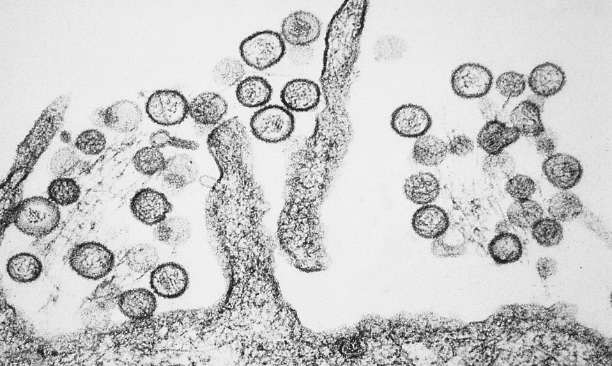 hantavirus 2 &raquo; Gnews Bahia
